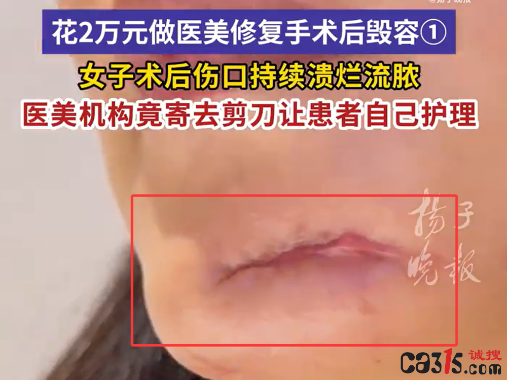 QQ20250624-231307.png